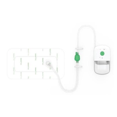 Avance Solo Incision...